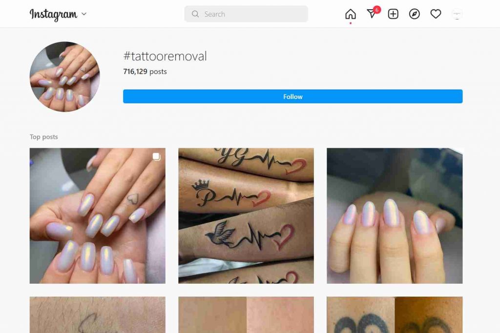 #Tattoo removal Hashtags 